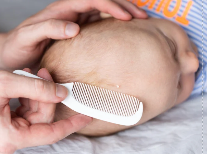 A Natural Remedy for Cradle Cap: Why Tallow Cream is Gaining Attention