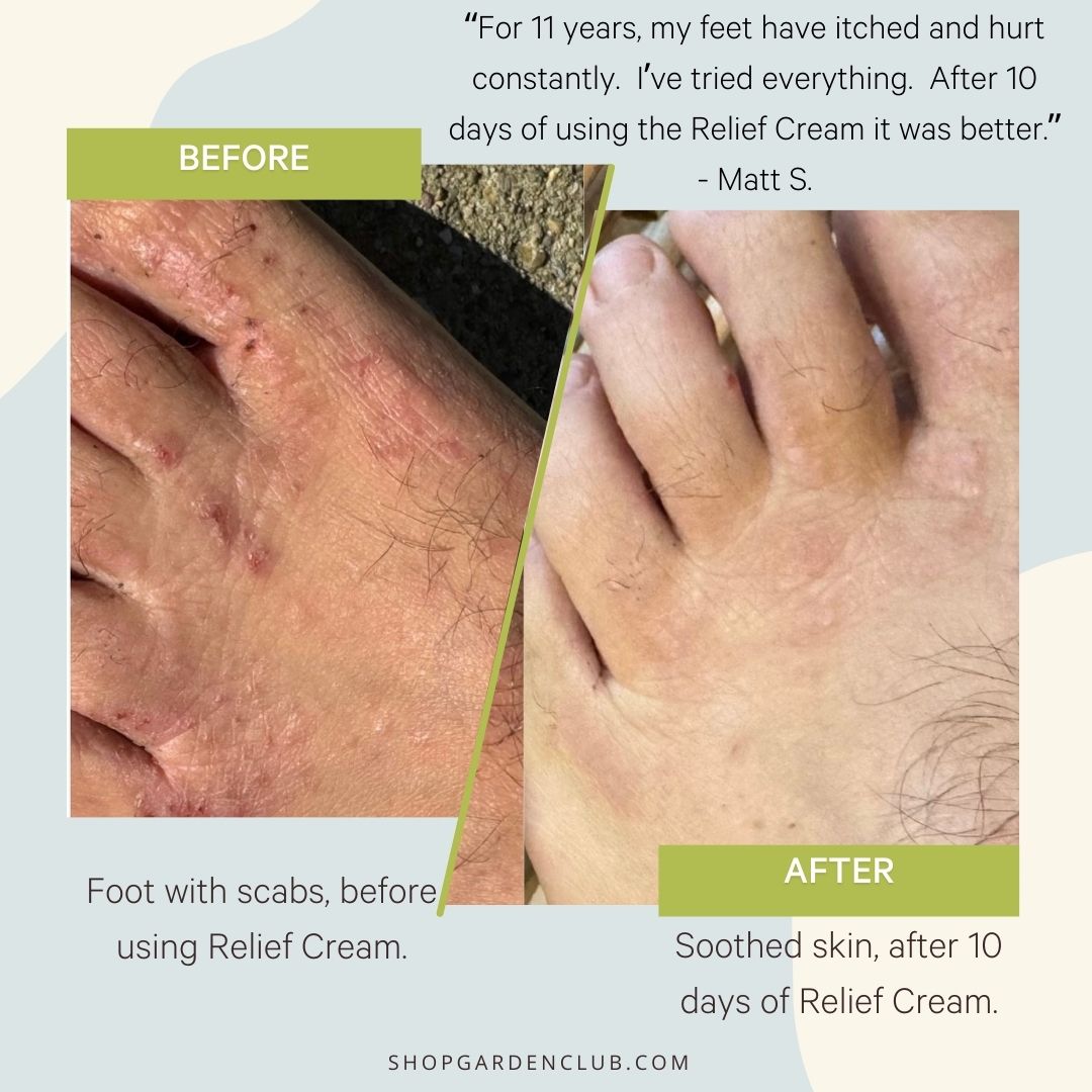 Skin Relief Tallow Balm before and after photo