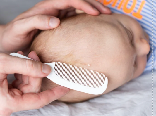 A Natural Remedy for Cradle Cap: Why Tallow Cream is Gaining Attention